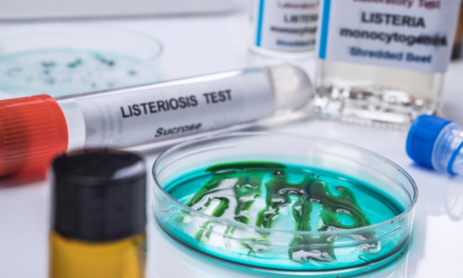 Listeria Monocytogenes: Perché fa tanta paura?